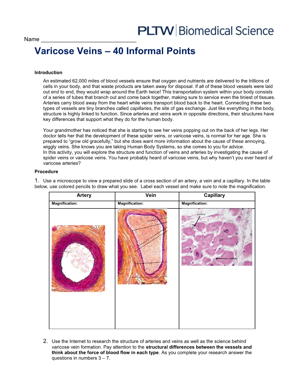 Varicose Veins 40 Informal Points