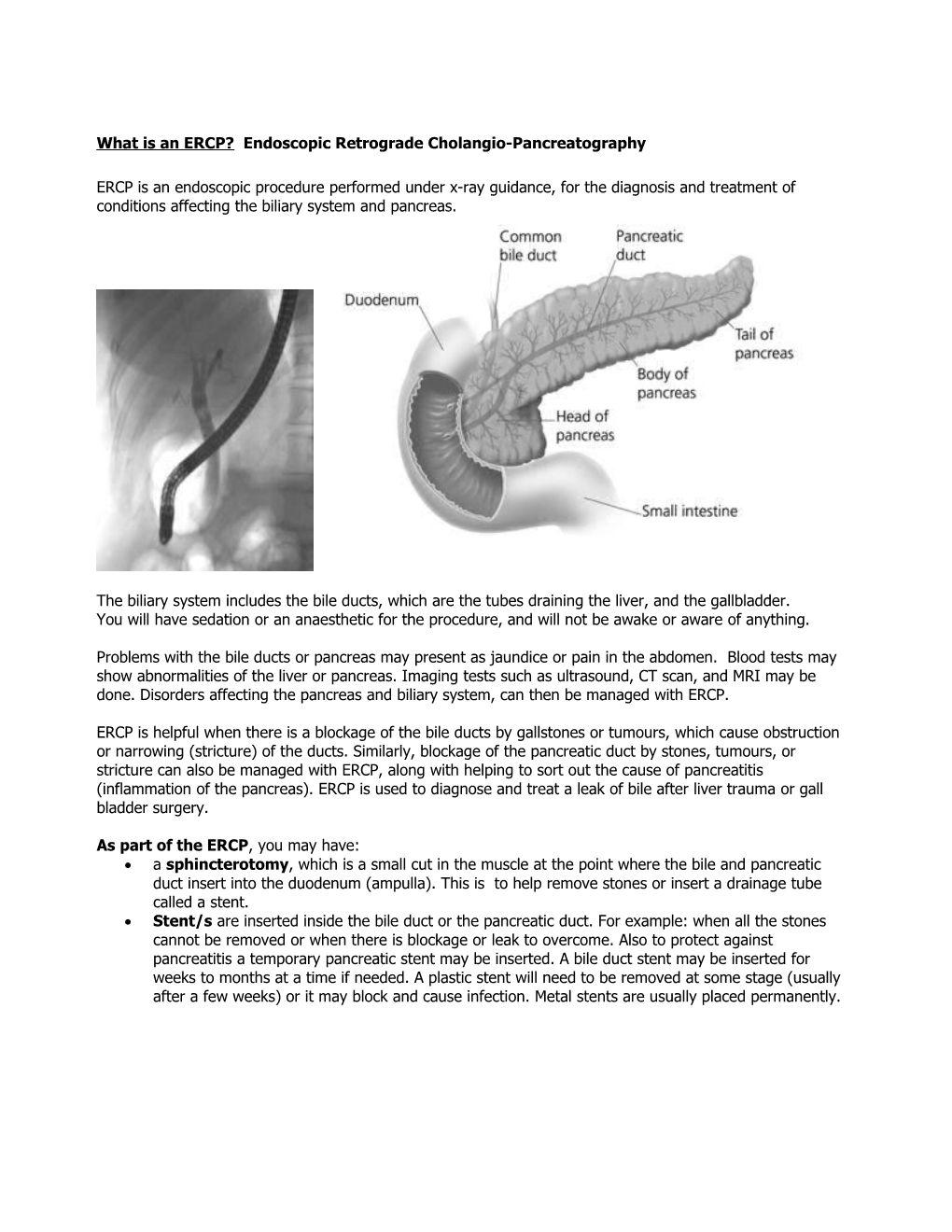 What Is an ERCP