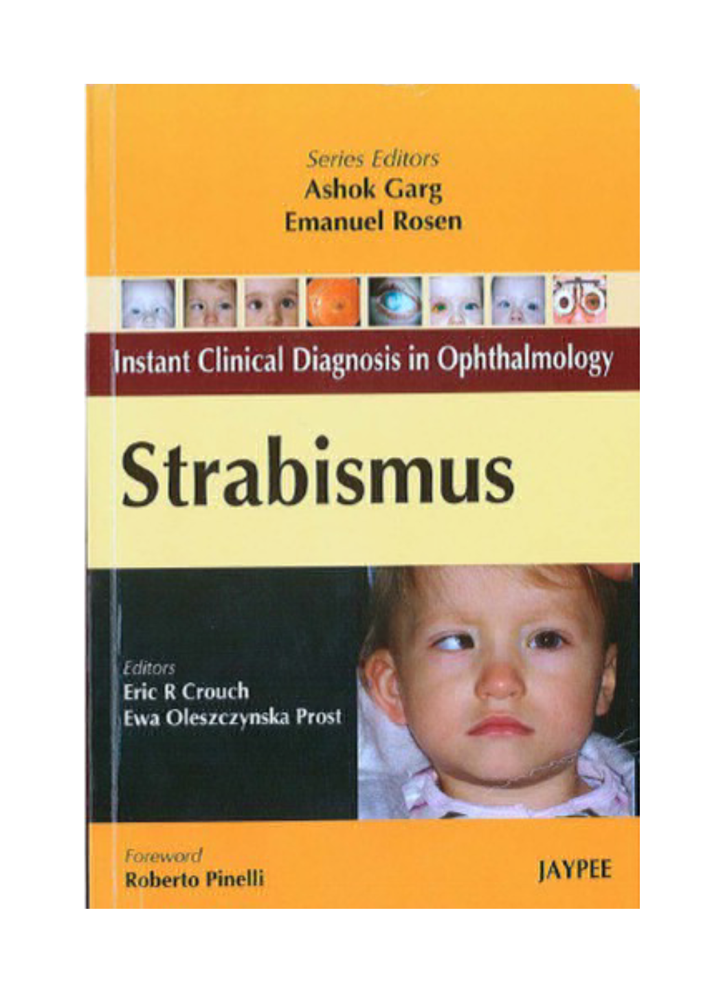 Concomitant Strabismus