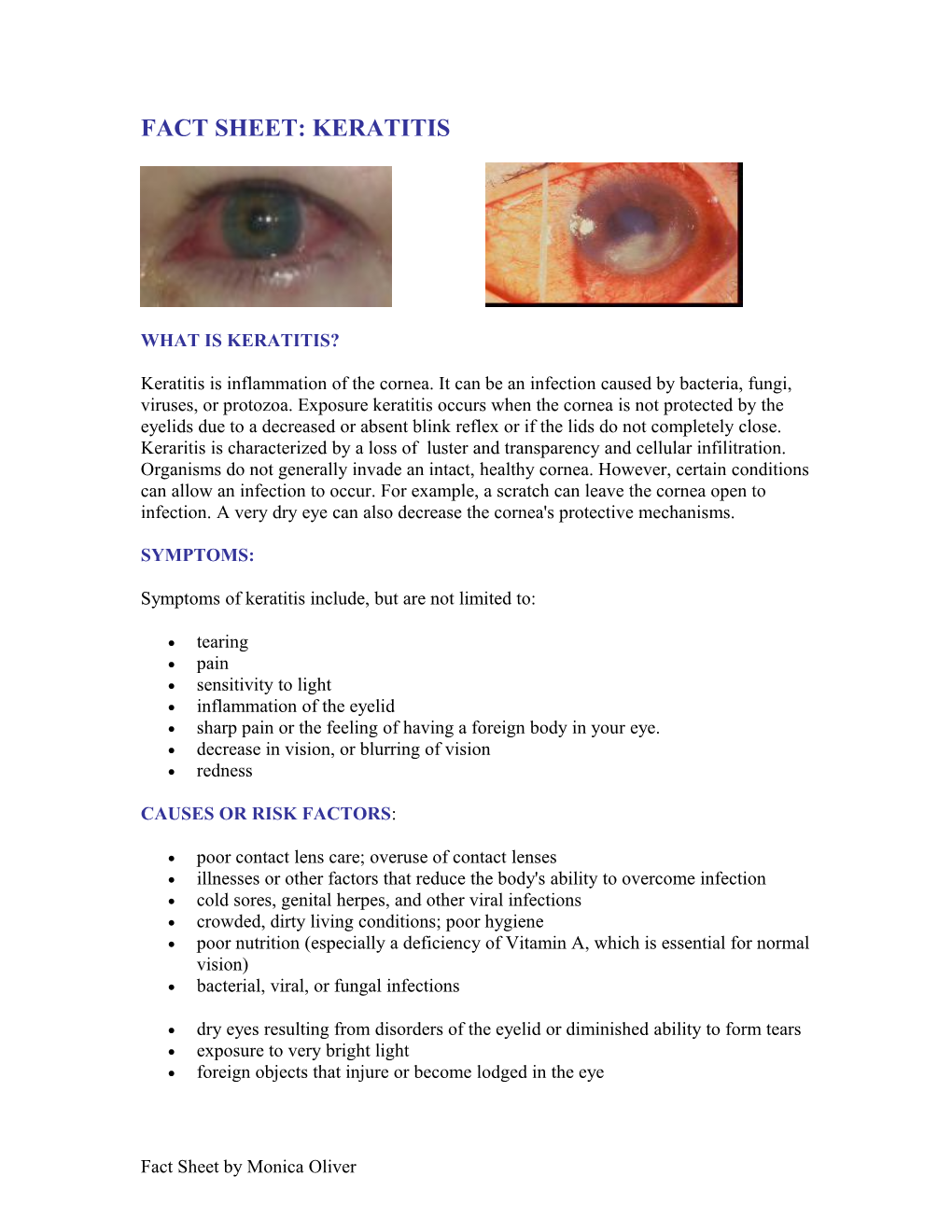 Fact Sheet: Keratitis