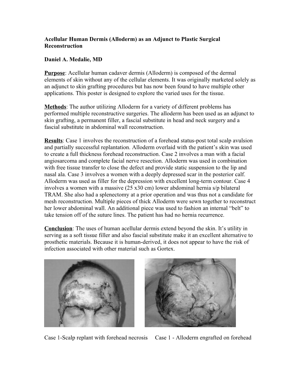 Composite Tissue Transfer for the Reconstruction of Multiple Tissue Defects of the Lower