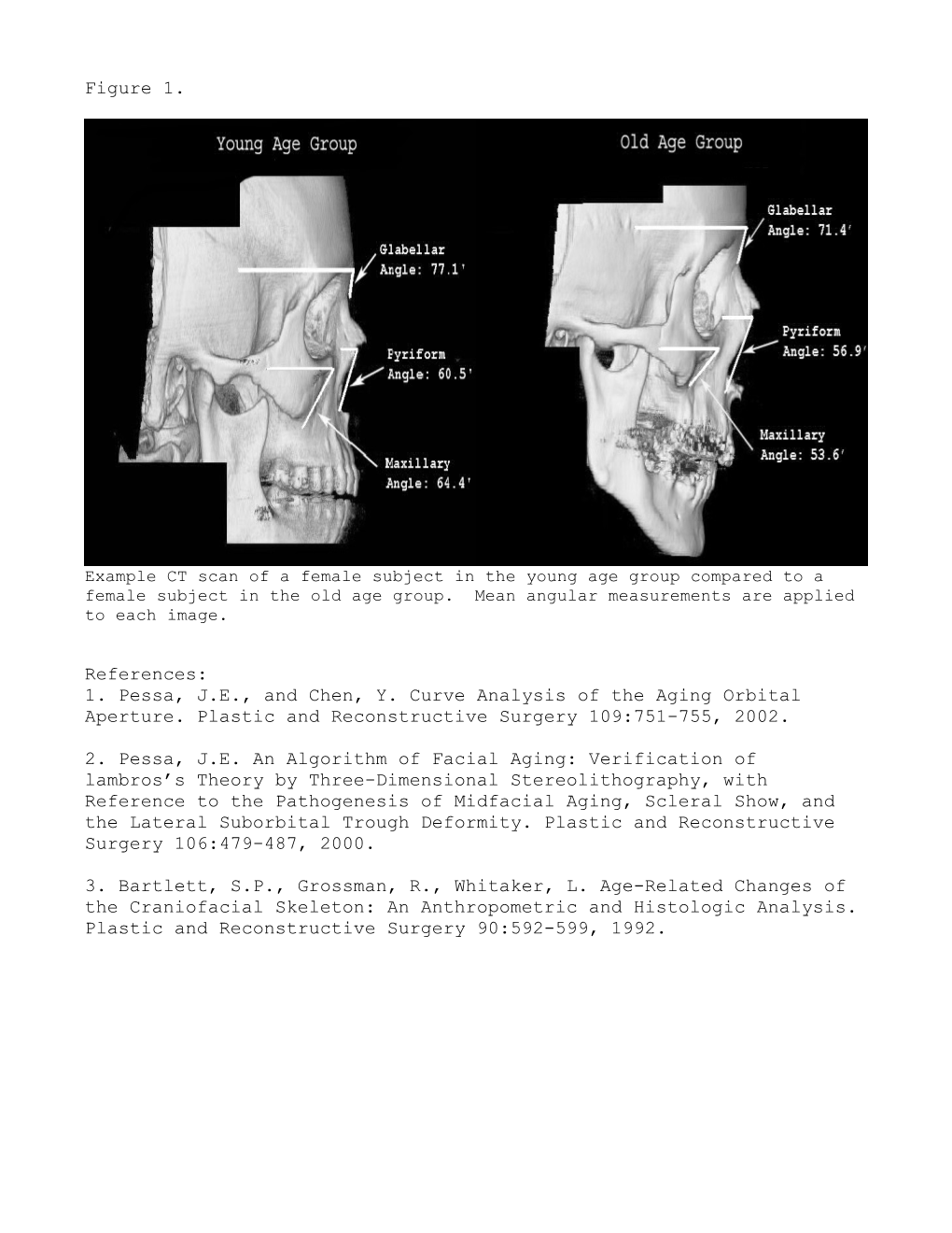 Title: Aging of the Mid-Face Bony Elements: a Three Dimensional CT Study