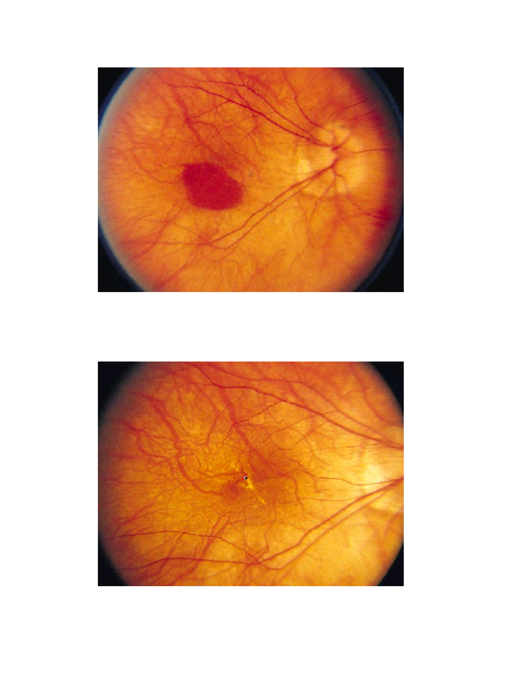Q: a 28-Year-Old Caucasian Woman Experienced a Central Light Flash Followed by Blurred Vision