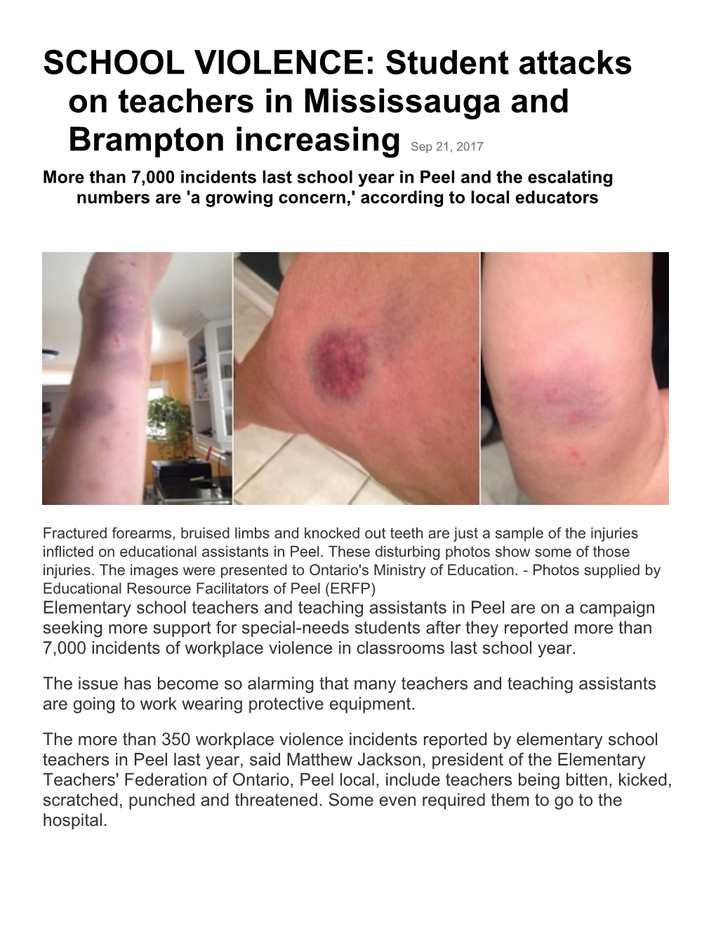 SCHOOL VIOLENCE: Student Attacks on Teachers in Mississauga and Brampton Increasingsep 21, 2017