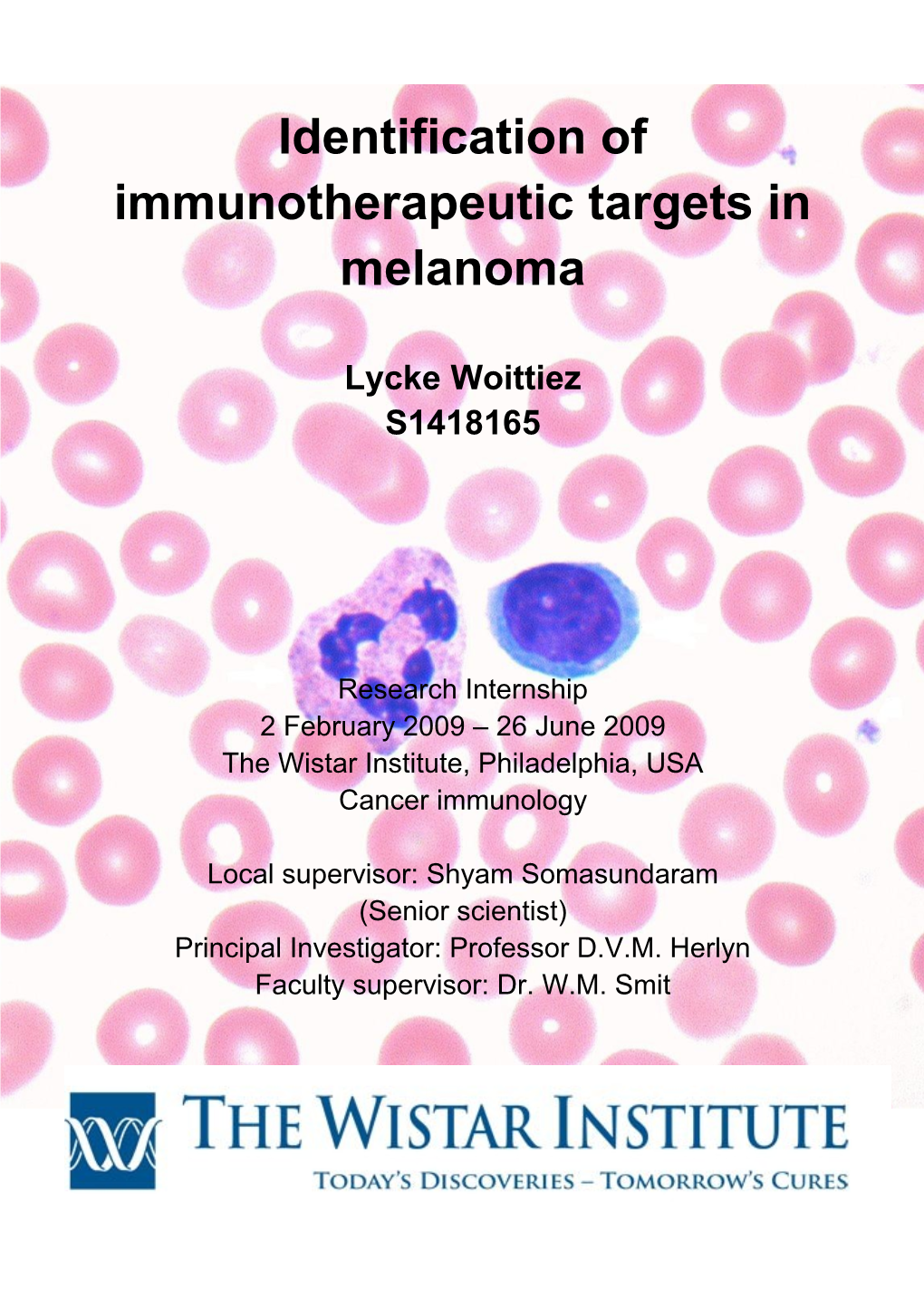 Identification of Immunotherapeutic Targets in Melanoma