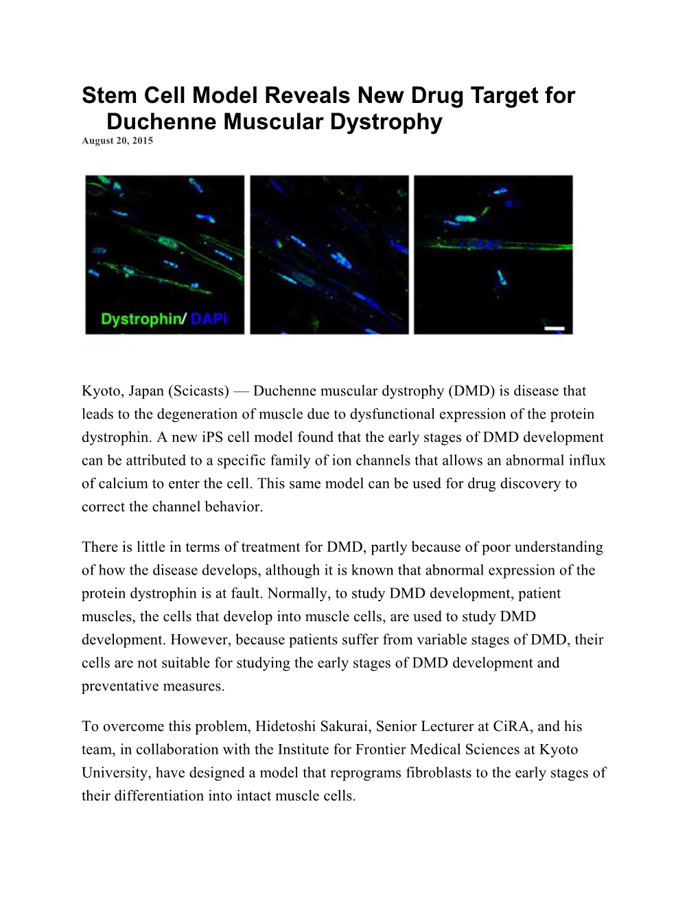 Stem Cell Model Reveals Newdrug Target for Duchenne Muscular Dystrophy
