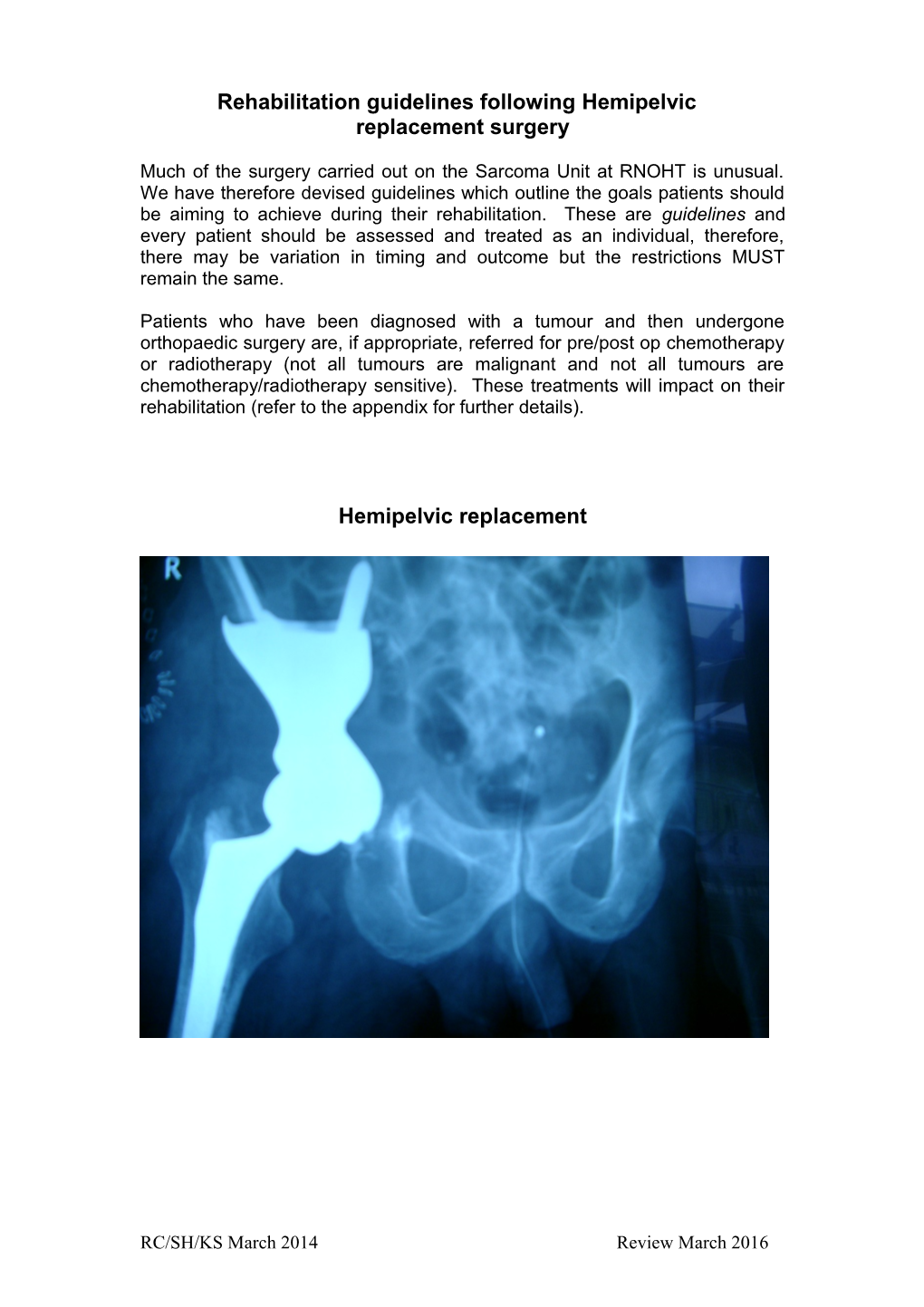 Rehabilitation Guidelines Following Hemipelvic