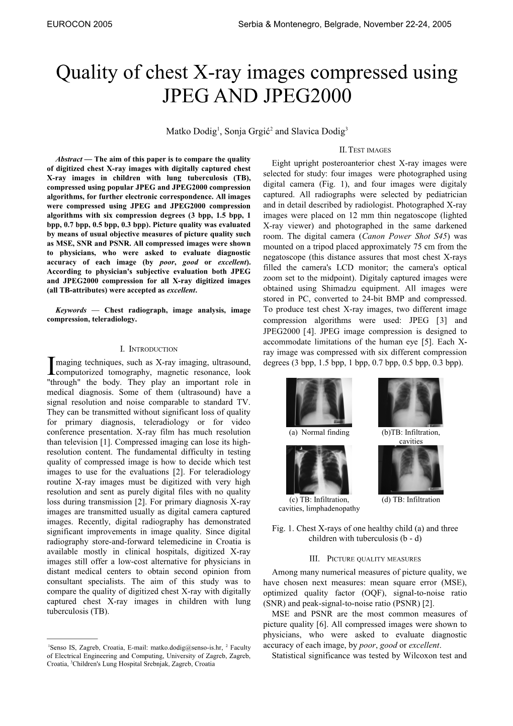 Quality of Chest X-Ray Images Compressed Using JPEG and JPEG2000