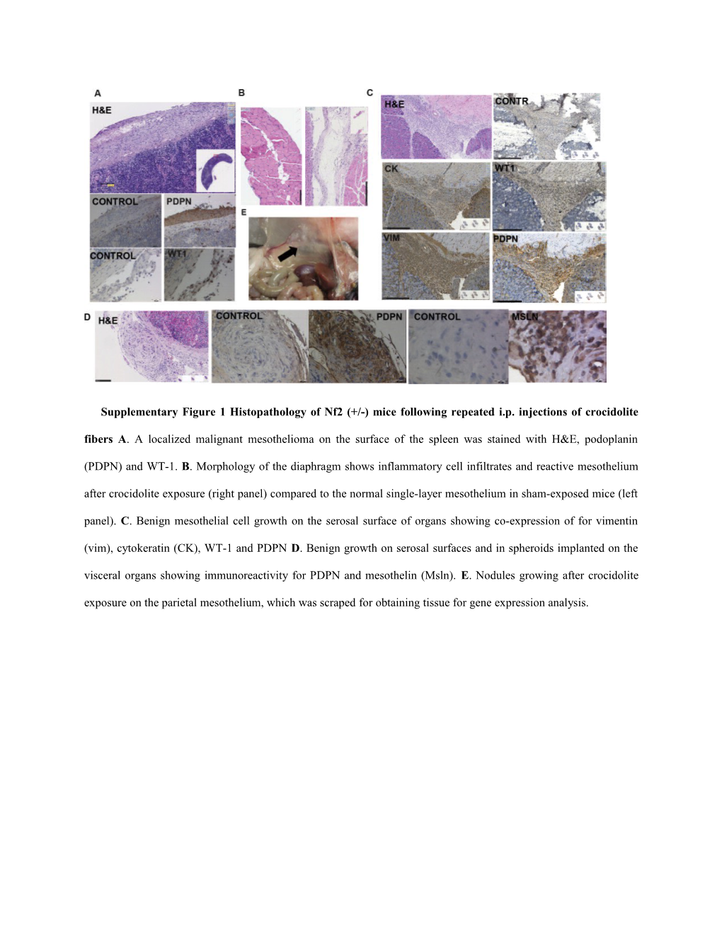 Supplementary Figure 1 Histopathology of Nf2 (+/-) Mice Following Repeated I.P. Injections