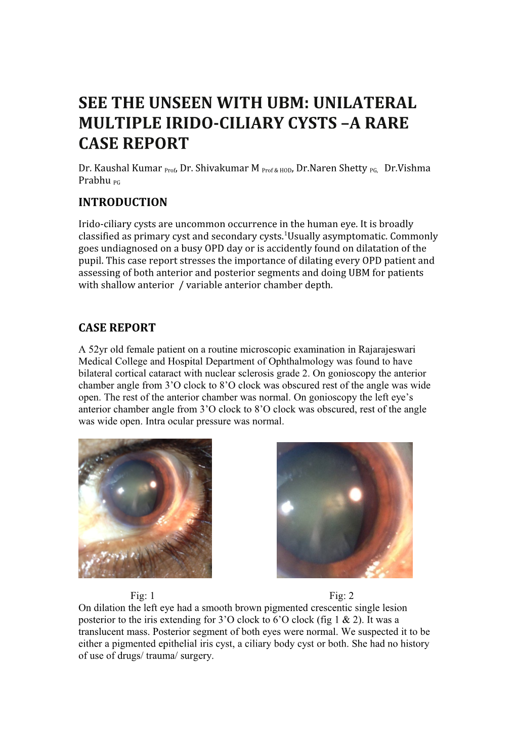 See the Unseen with Ubm: Unilateral Multiple Irido-Ciliary Cysts a Rare Case Report