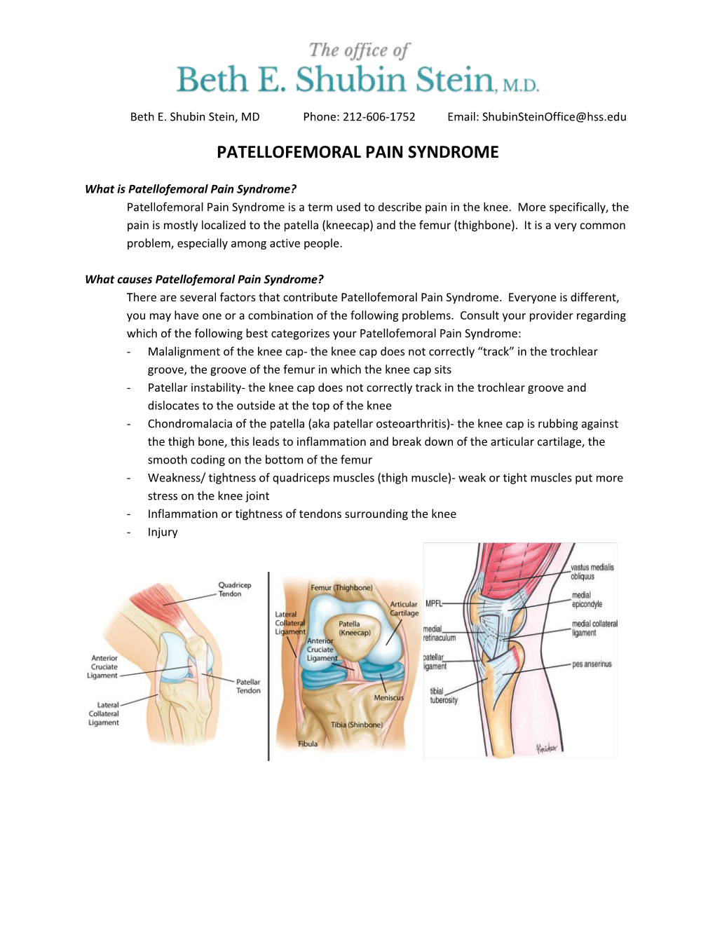 What Is Patellofemoral Pain Syndrome?