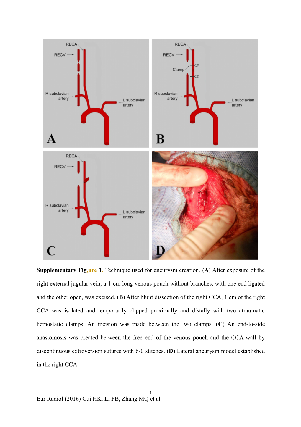 Magnesium Alloy Covered Stent for a Lateral Aneurysm Model in Rabbit Common Carotid Artery