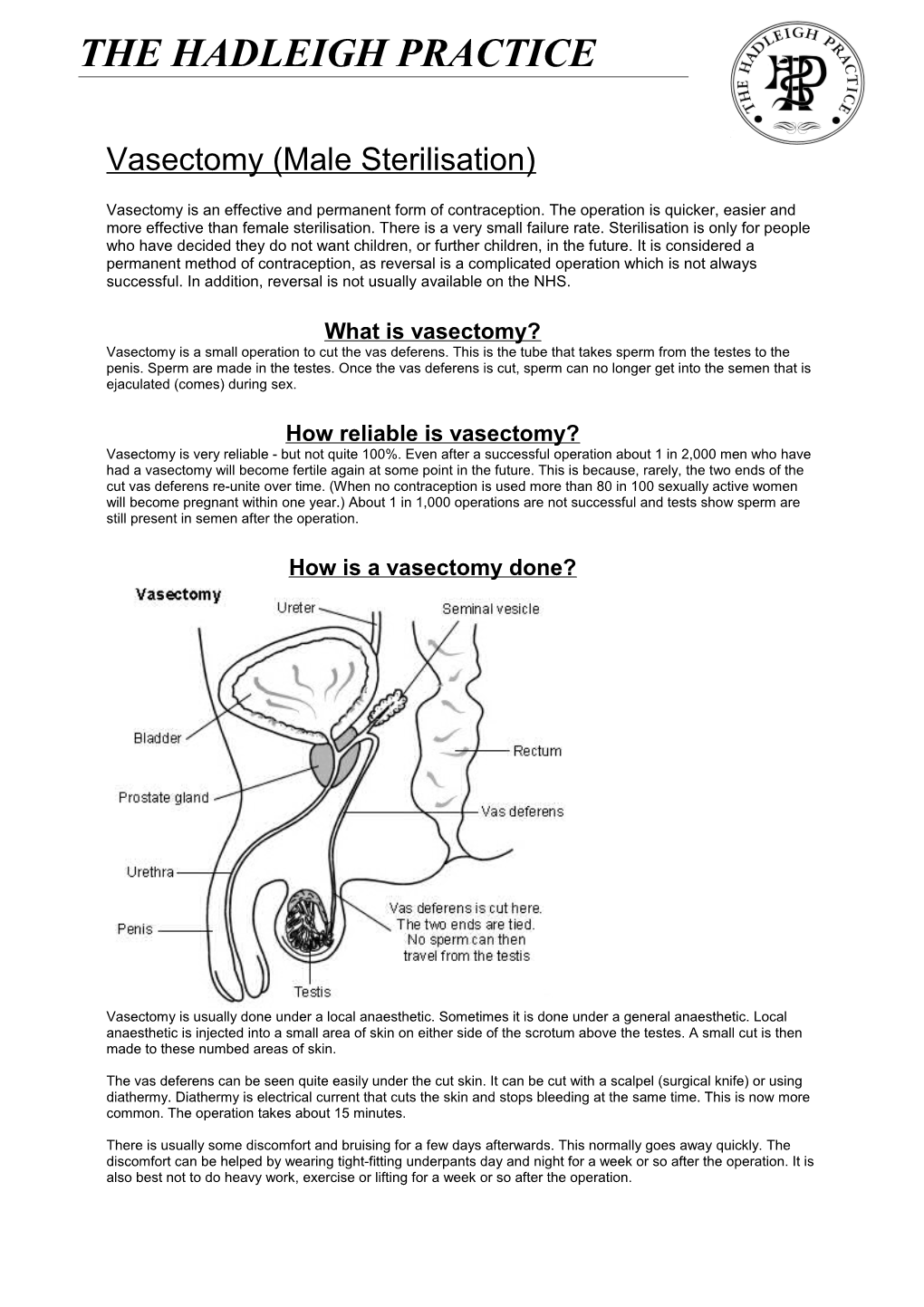 Vasectomy (Male Sterilisation)