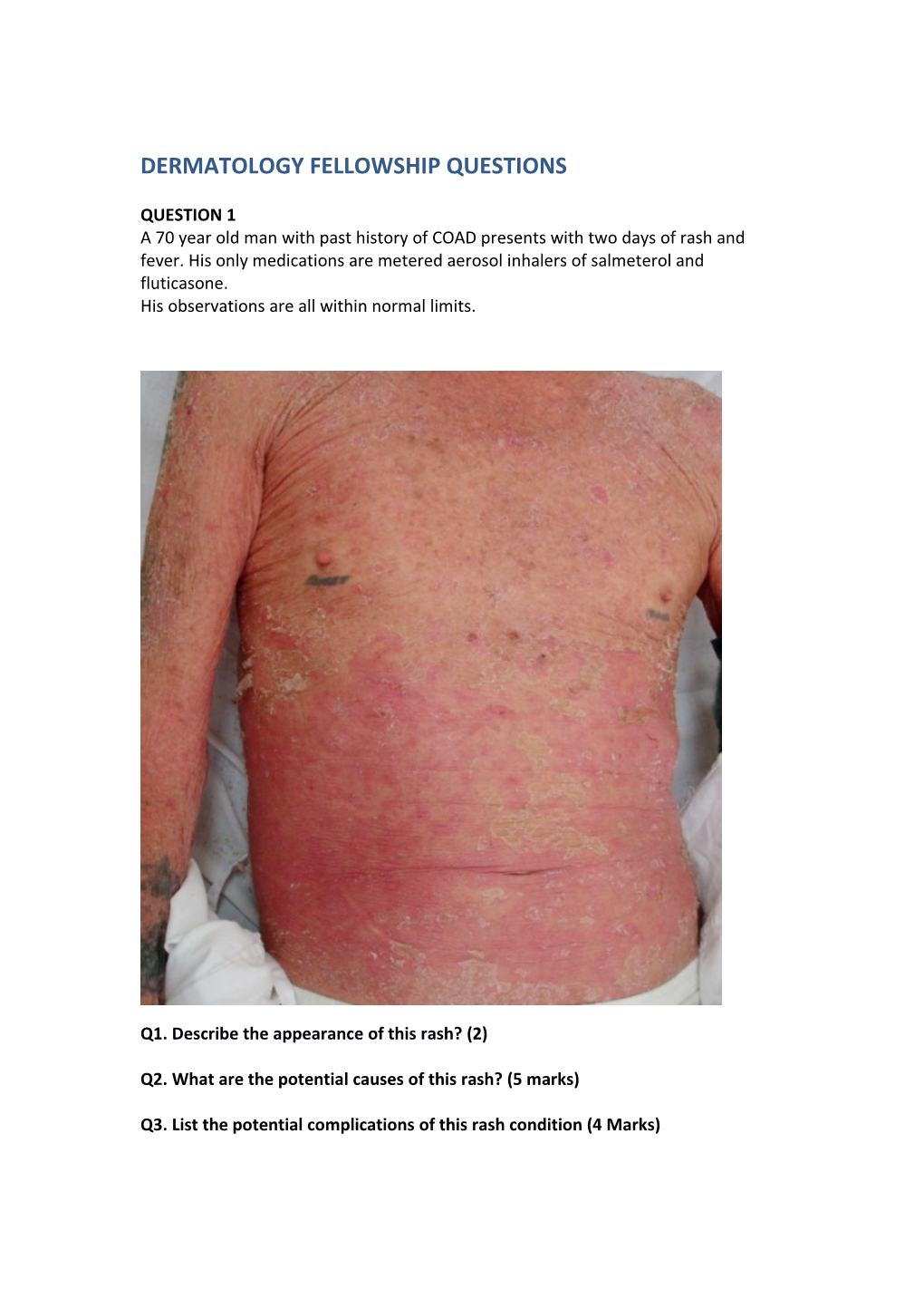 Dermatology Fellowship Questions