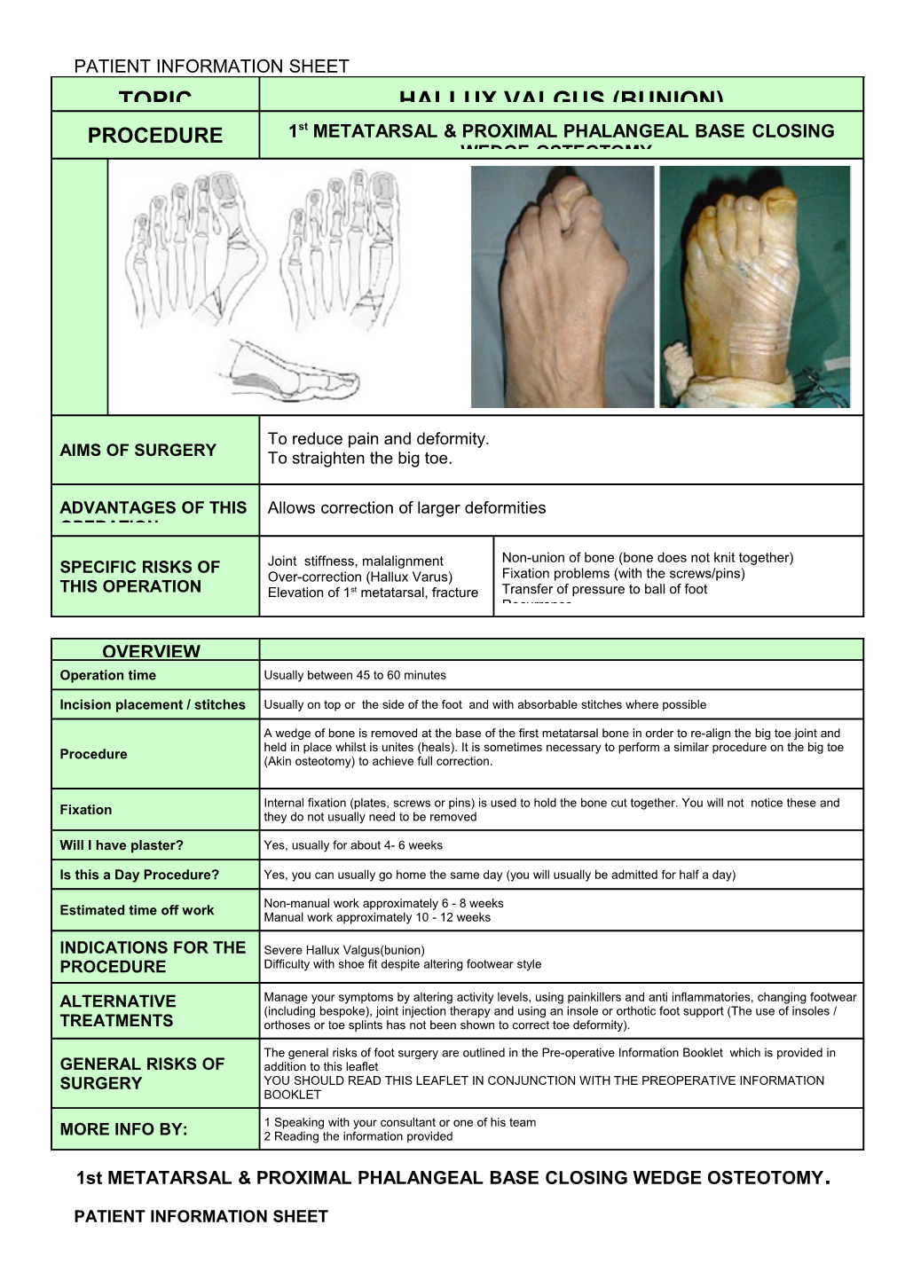 1St METATARSAL & PROXIMAL PHALANGEAL BASE CLOSING WEDGE OSTEOTOMY