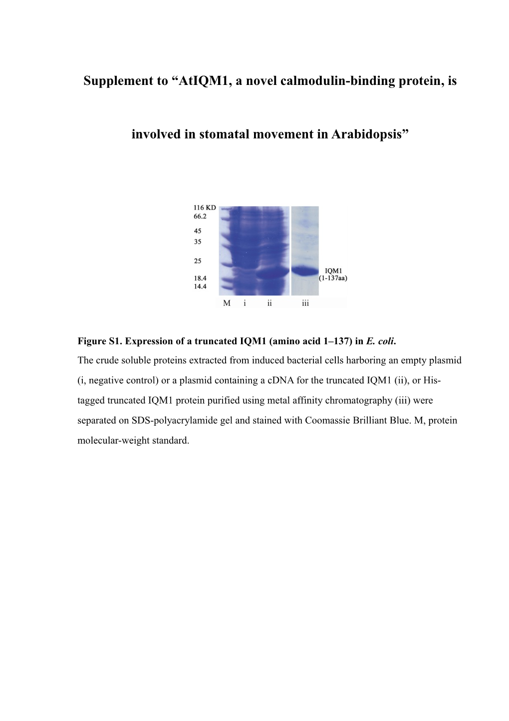 Figure S1.Expression of a Truncated IQM1 (Amino Acid 1 137) in E. Coli