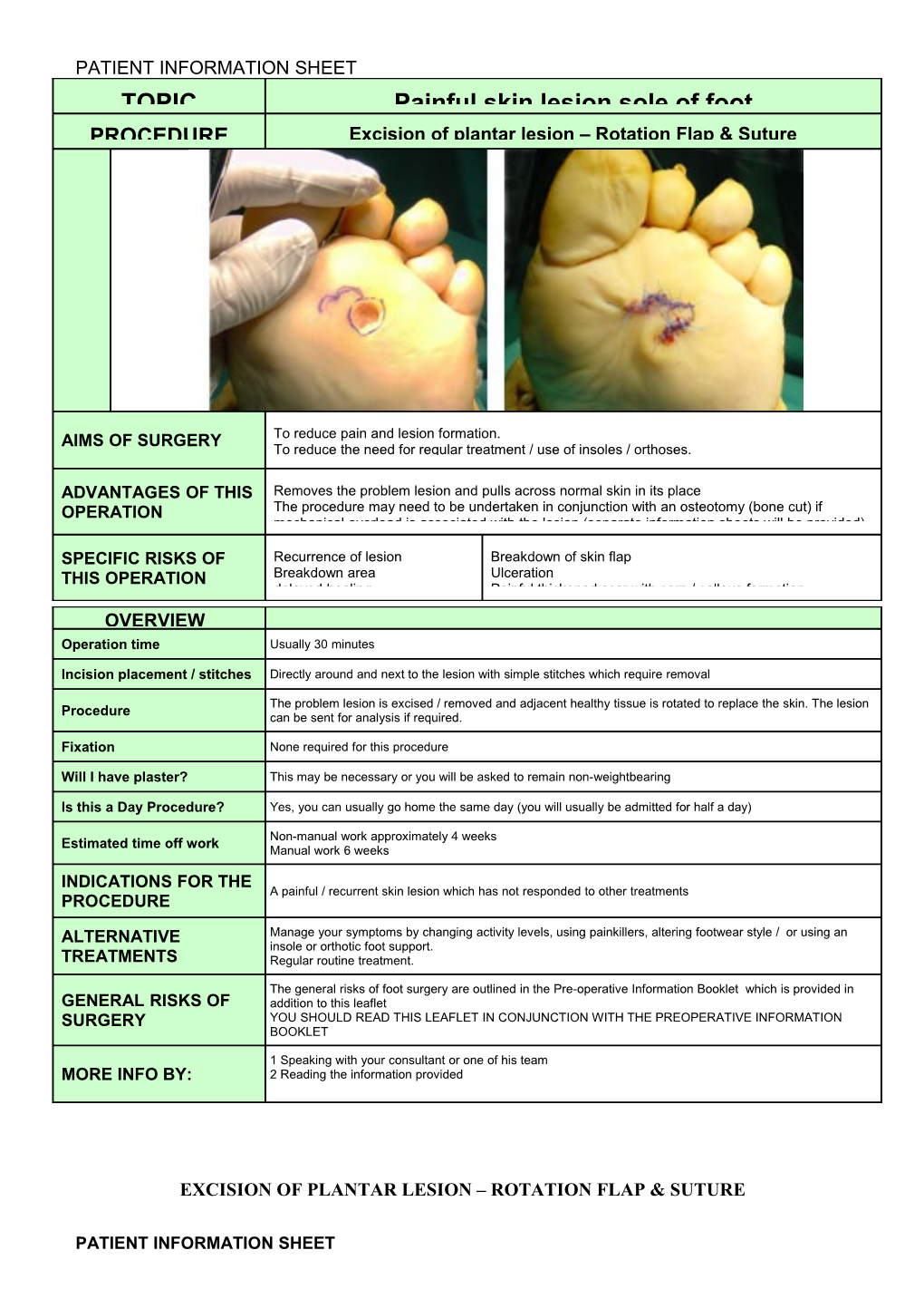 Excision of Plantar Lesion Rotation Flap & Suture