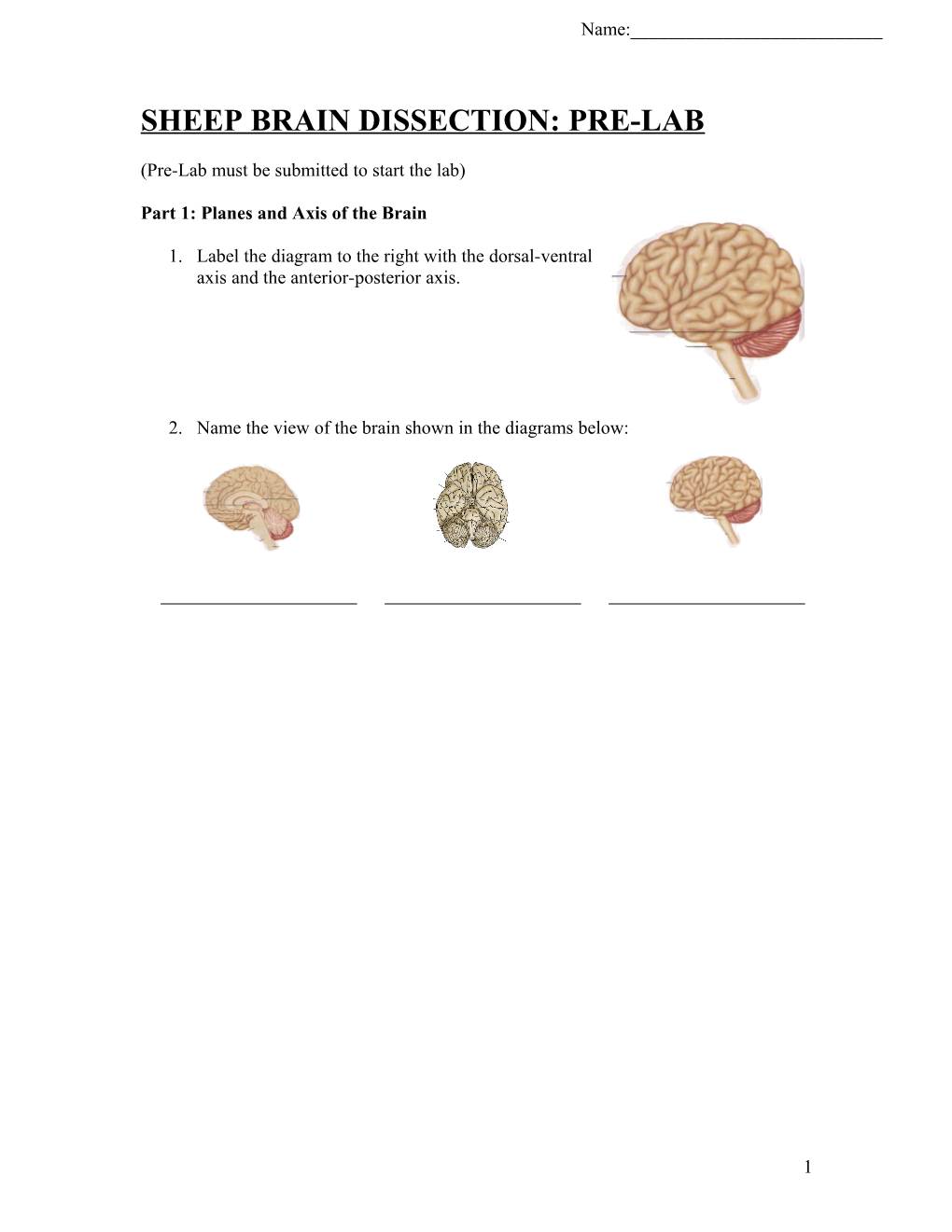 Sheep Brain Dissection