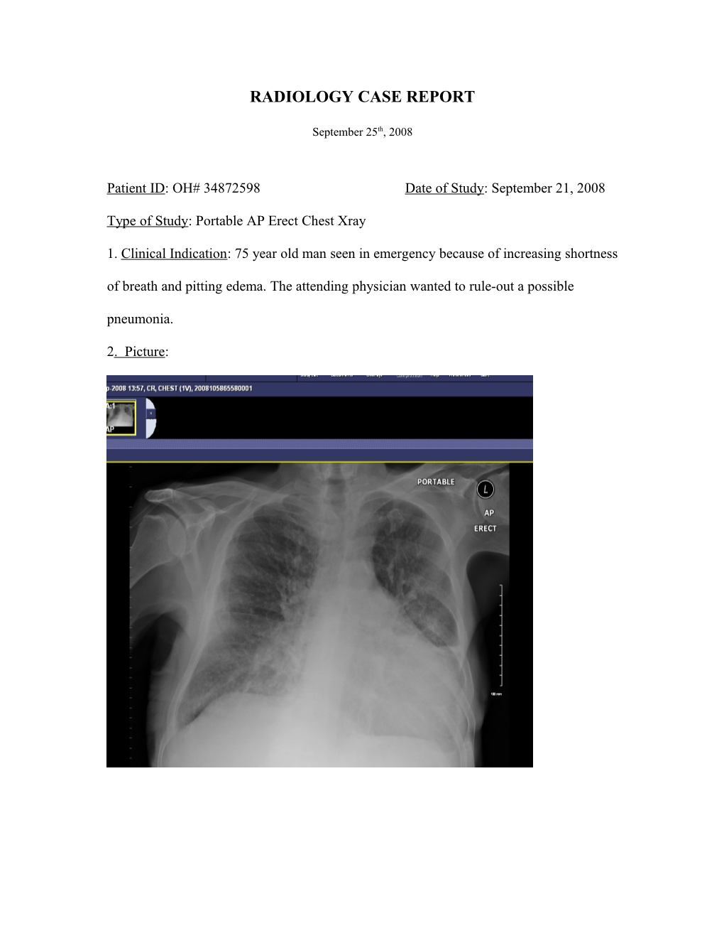 Radiology Case Report s1