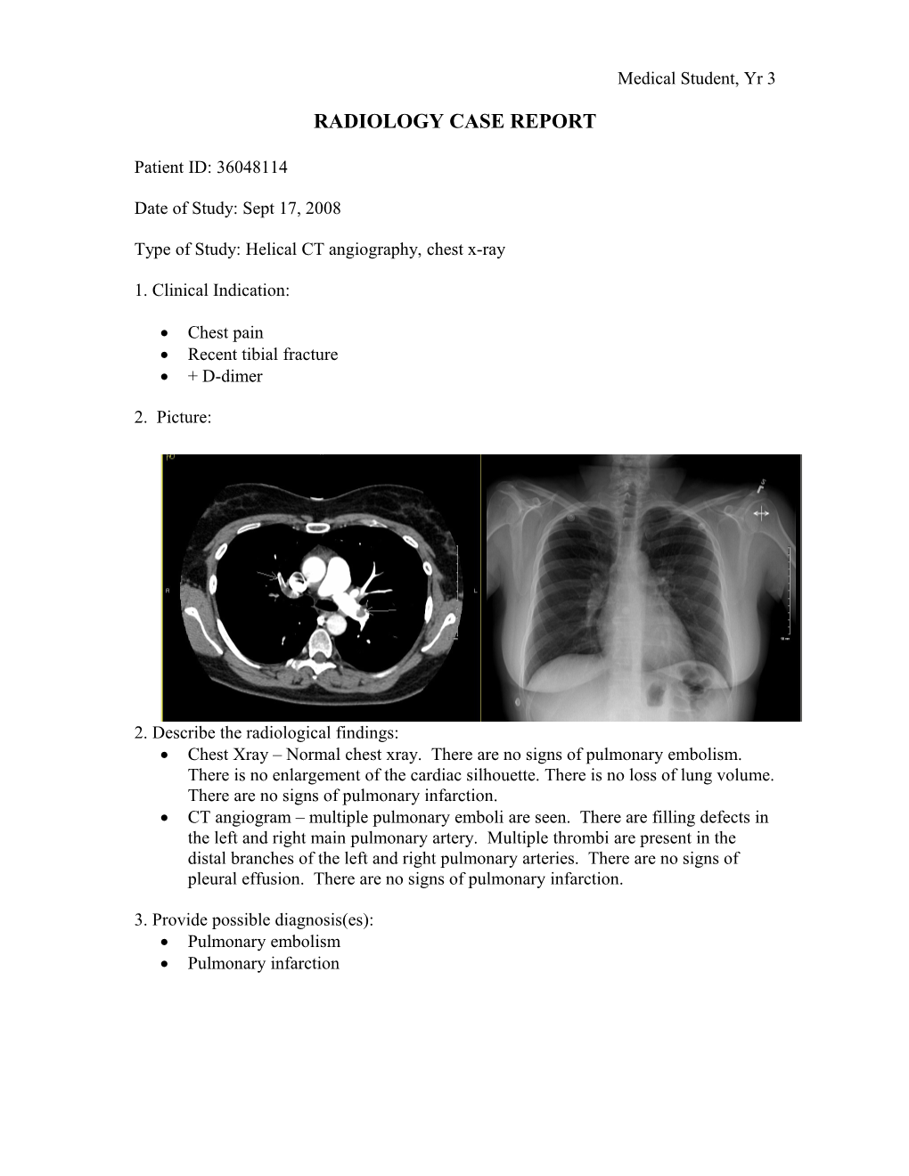 Radiology Case Report s2