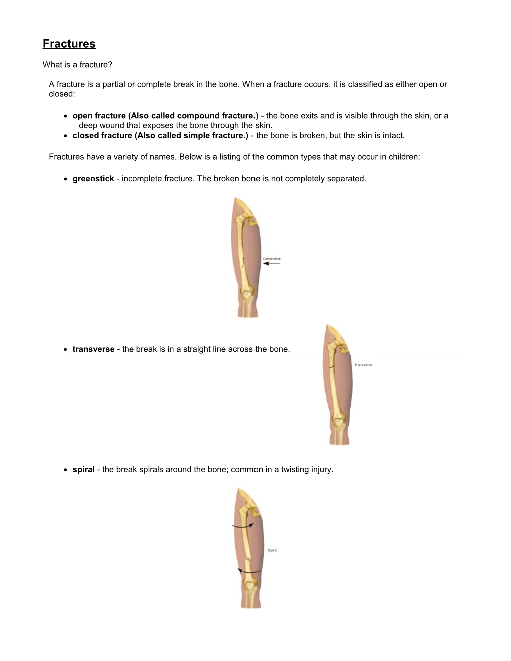 What Is a Fracture?