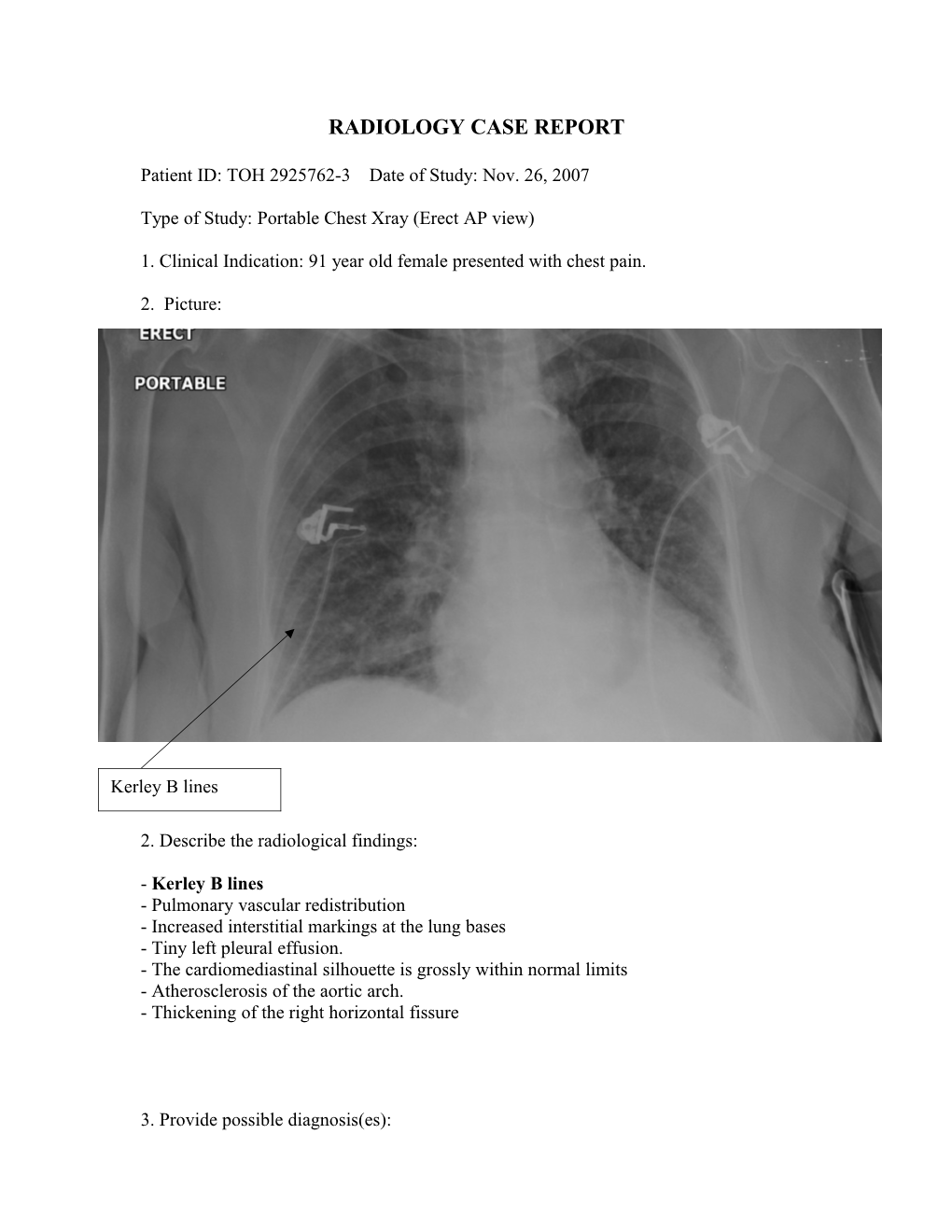 Radiology Case Report s4