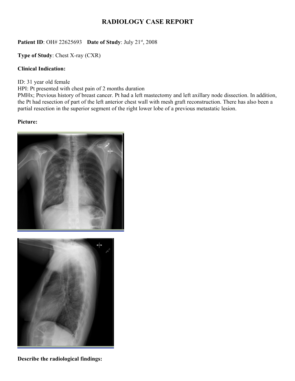 Radiology Case Report