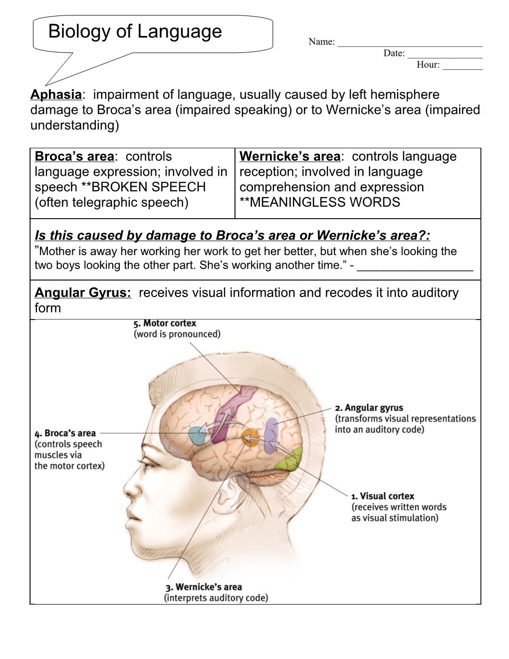 Aphasia: Impairment of Language, Usually Caused by Left Hemisphere Damage to Broca S Area