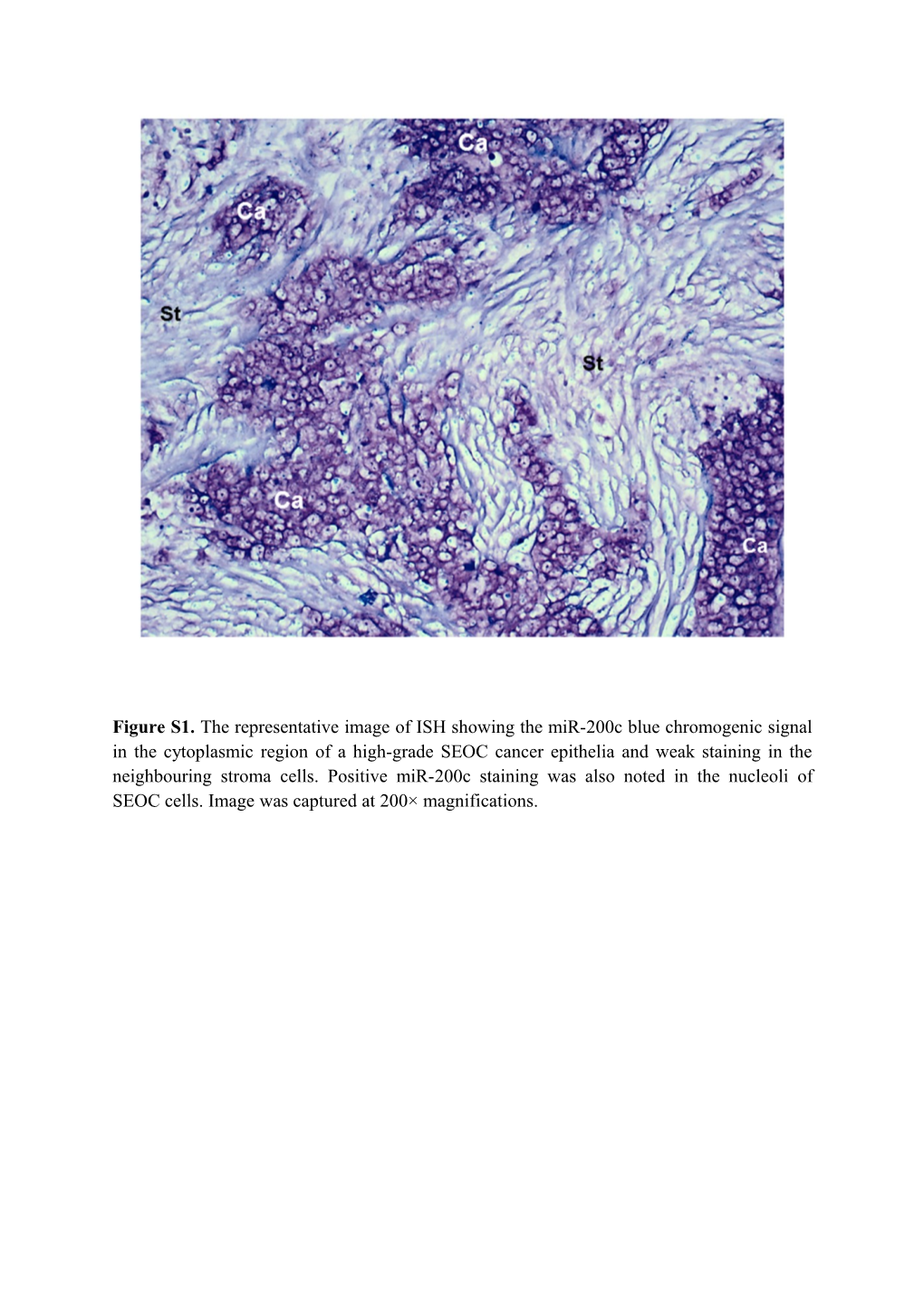 Figure S1. the Representative Image of ISH Showing the Mir-200C Blue Chromogenic Signal