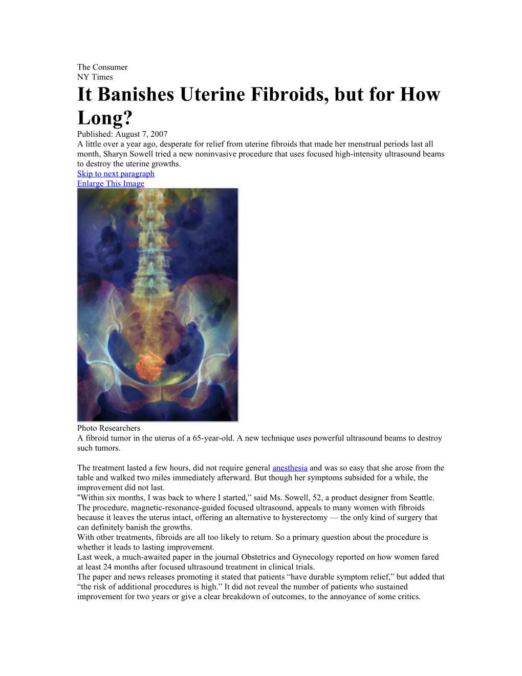 It Banishes Uterine Fibroids, but for How Long?