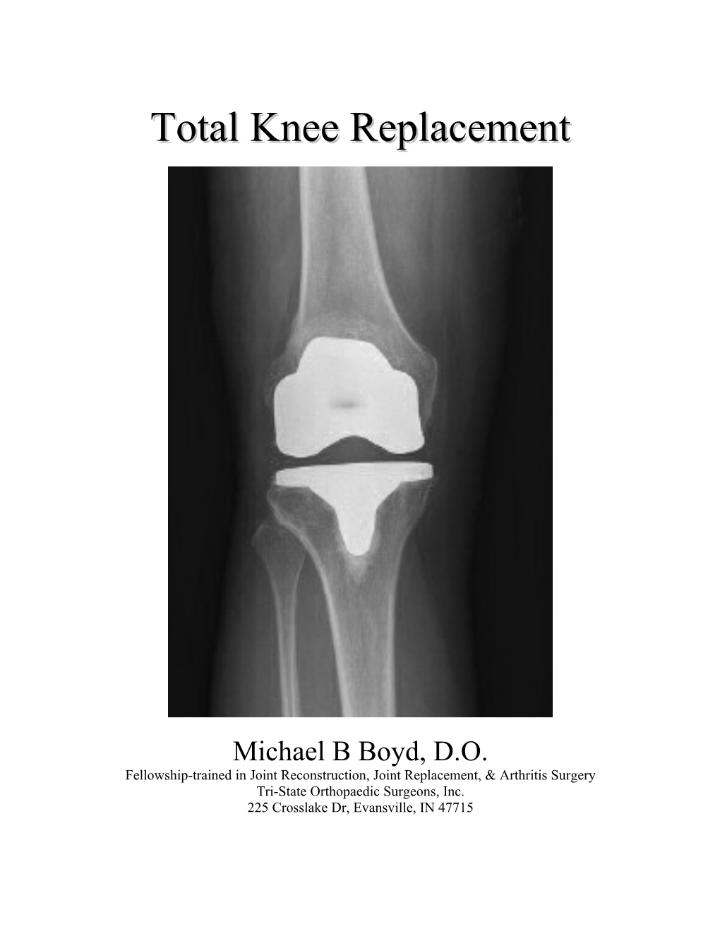 Total Knee Replacement