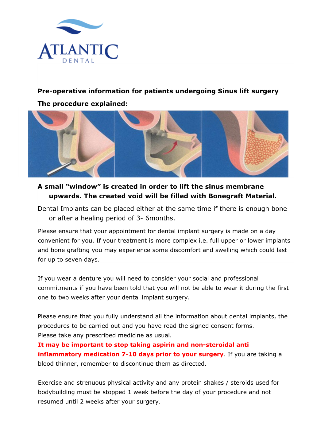 Pre-Operative Information for Patients Undergoing Sinus Lift Surgery