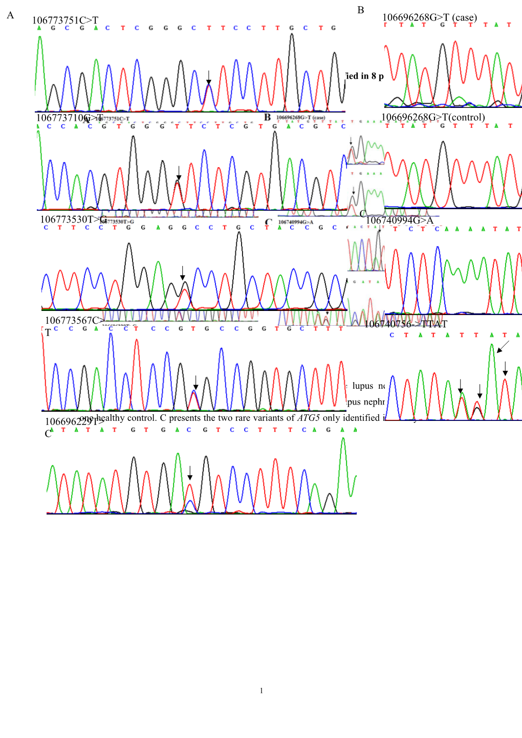 Supplementary Fig1. the Sequence Rare Variants of ATG5 Identified in 8 Patients and One