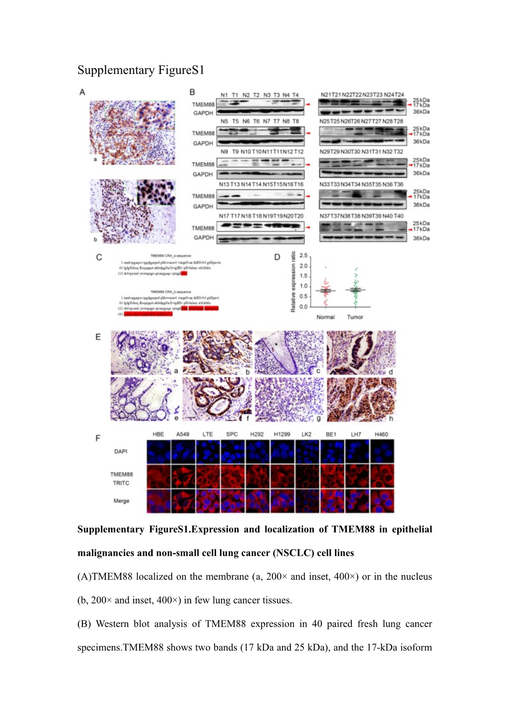 Supplementary Figures1.Expression and Localization of TMEM88 in Epithelial Malignancies
